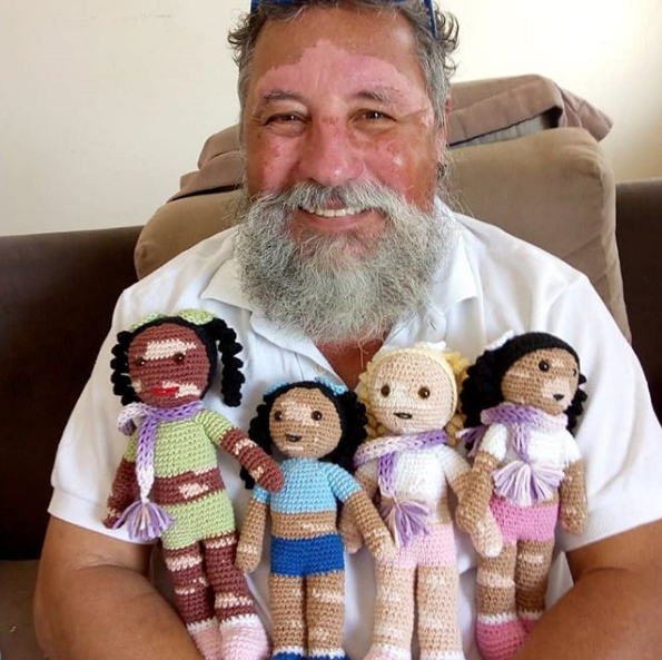 1-vovo-com-vitiligo-confecciona-bonecas-para-estimular-a-autoestima-de-criancas 1-vovo-com-vitiligo-confecciona-bonecas-para-estimular-a-autoestima-de-criancas